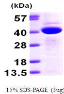 Human CAB39 / MO25 Protein (Recombinant His)