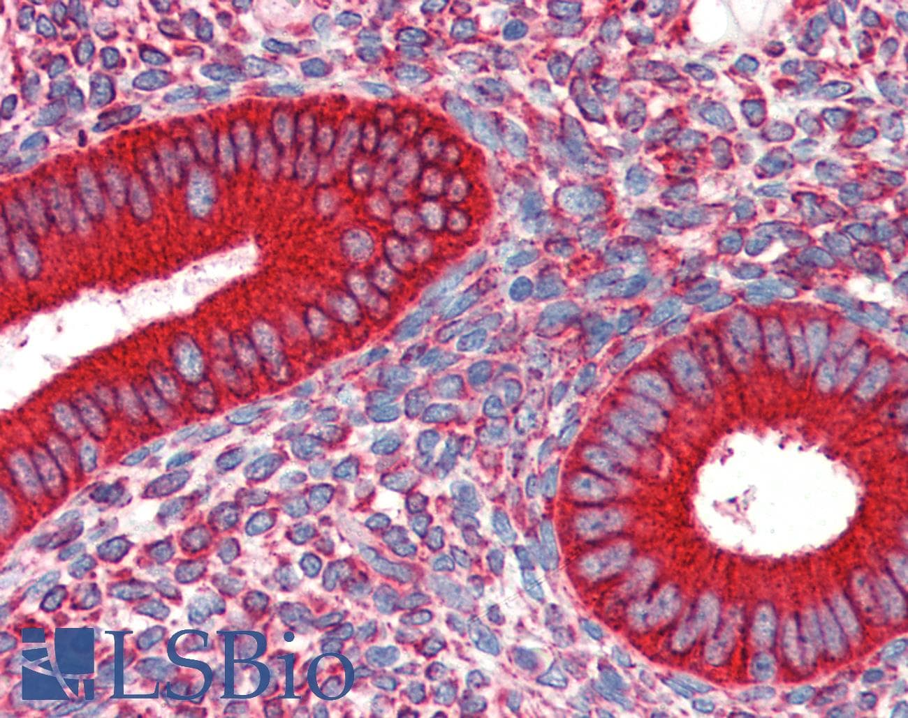 IHC-plus™ HSP90B1 / GP96 / GRP94 Antibody (clone 9G10)