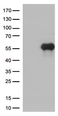 HAVCR2 / TIM-3 Antibody (clone OTI8H7, Carrier-free)