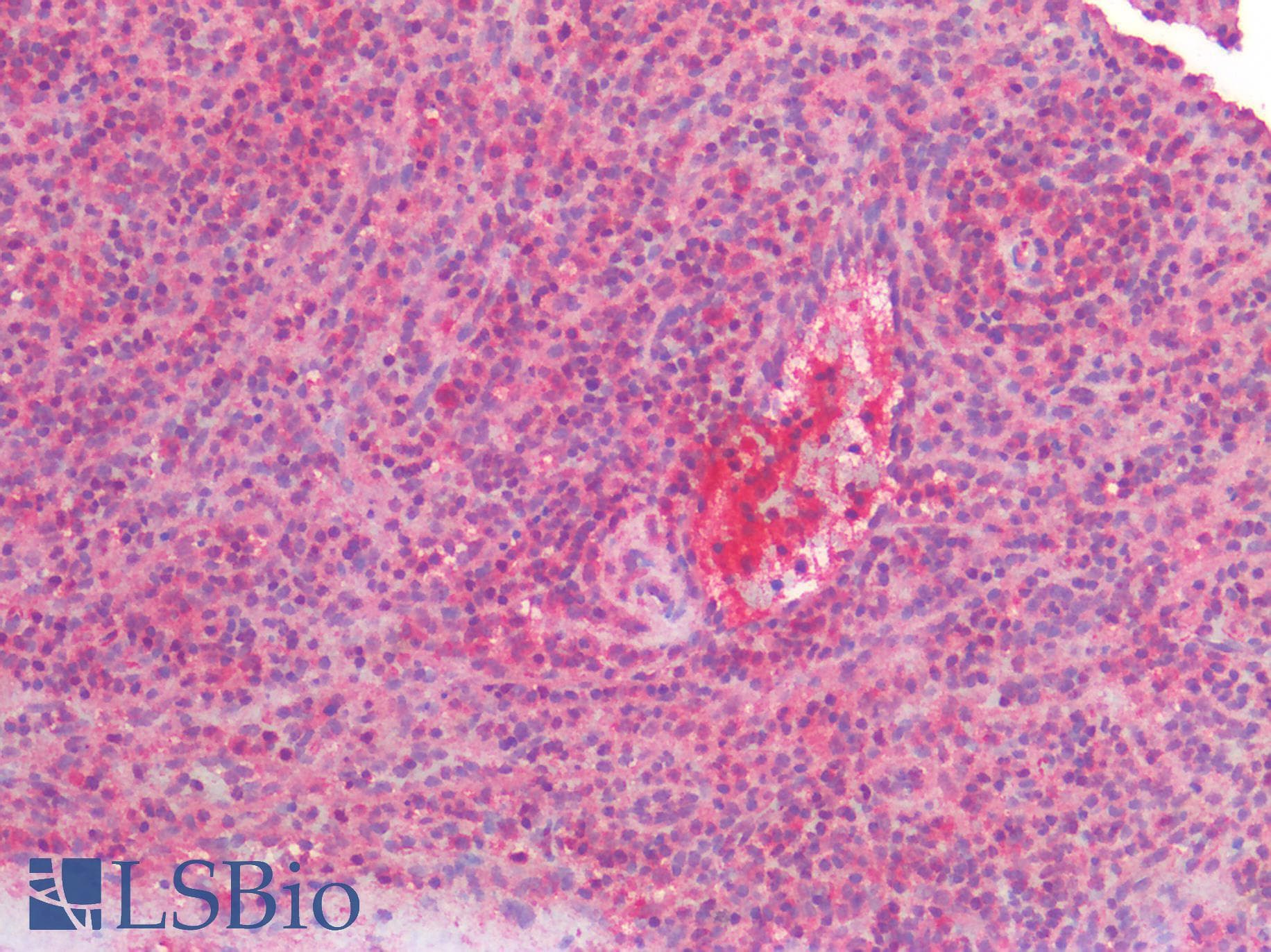 PathPlus™ Polyclonal Rabbit anti-Human BCL2 / Bcl-2 Antibody (IHC)