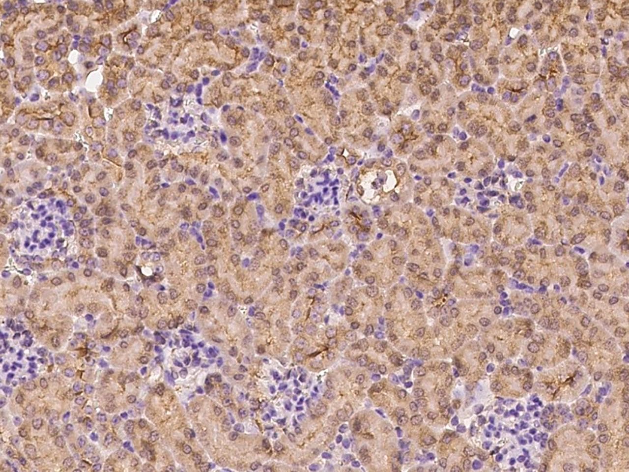 CRABP2 Antibody (Preservative Free)