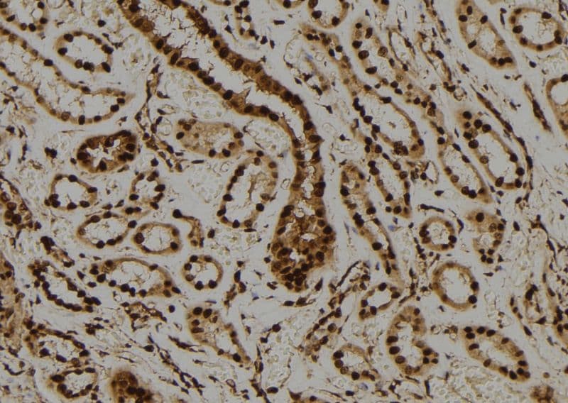 Polyclonal Rabbit anti-Human PML Antibody (IHC, IF, WB)