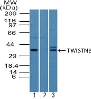 TWISTNB Antibody (aa50-100)