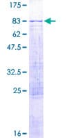 Human ADAD1 Protein (Recombinant GST)