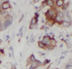 DVL1 / DVL / Dishevelled Antibody