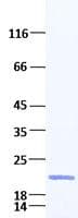 Human FGF10 Protein (Recombinant)