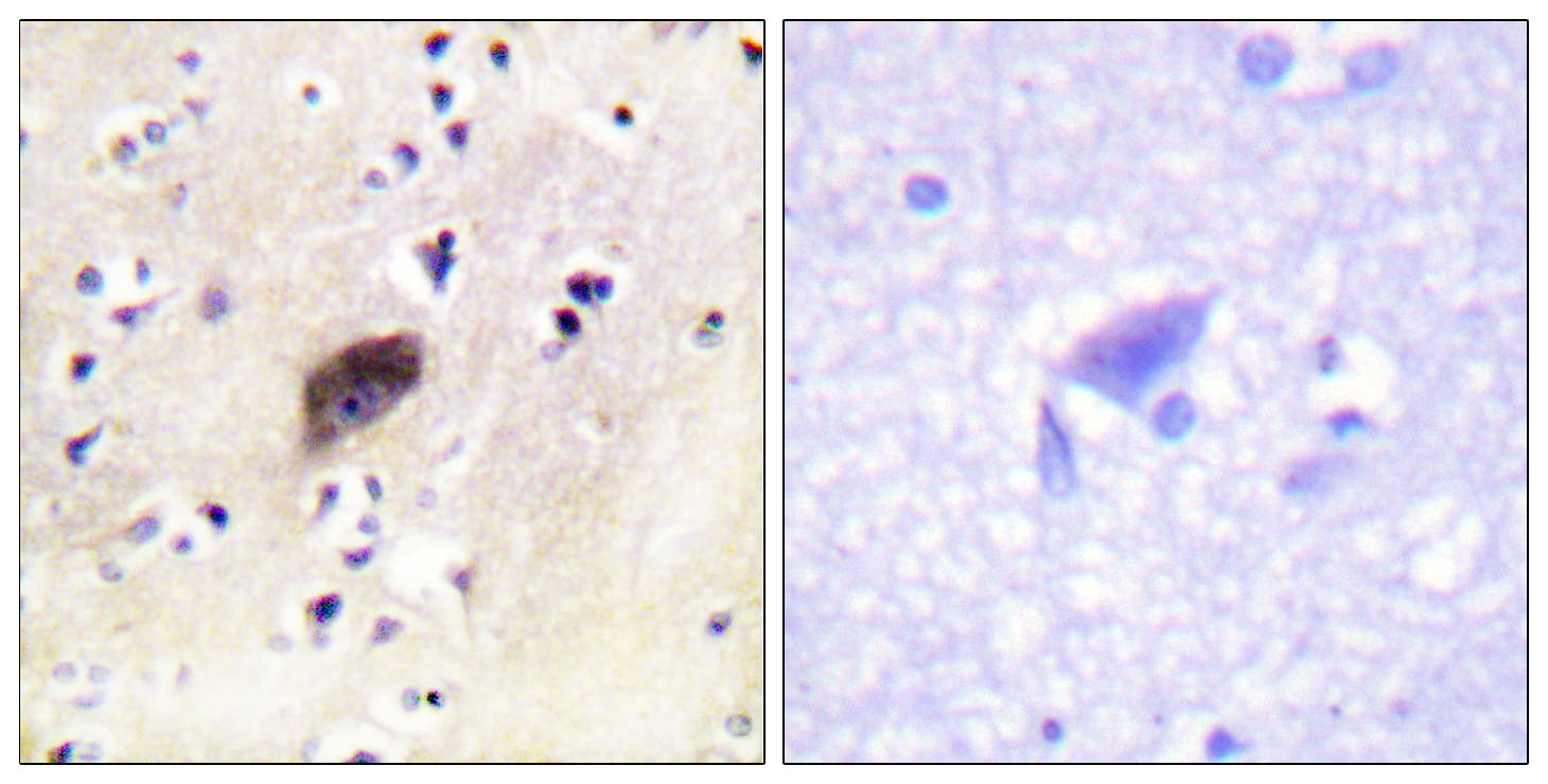 Polyclonal Rabbit anti-Human PAK1 + PAK2 + PAK3 Antibody (phospho-Ser144/Ser141/Ser139, IHC, WB)