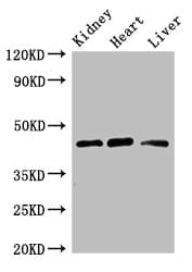 Polyclonal Rabbit anti-Human WTAP Antibody (IHC, IF, WB)