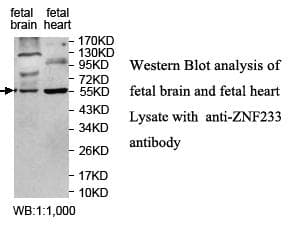 Polyclonal Rabbit anti-Human ZNF223 Antibody (aa88-358, IHC, WB)