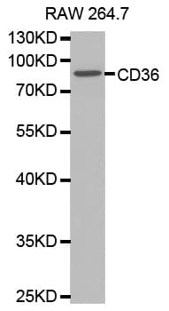 PathPlus™ Polyclonal Rabbit anti-Human CD36 Antibody (IHC, WB)