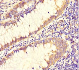 DAAM2 Antibody