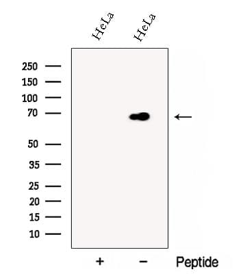 Polyclonal Rabbit anti-Human DCP1B Antibody (WB)