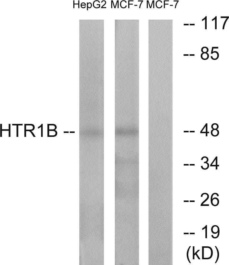 Polyclonal Rabbit anti-Human HTR1B / 5-HT1B Receptor Antibody (IF, WB)