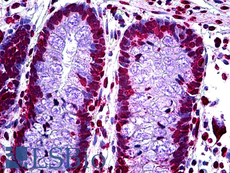 IHC-plus™ p16INK4a / CDKN2A Antibody (clone 1E12E10)
