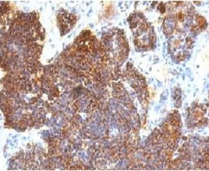 PTH / Parathyroid Hormone Antibody (C-Terminus, clone PRTM1-3, Ready-to-Use)