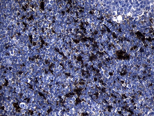 Monoclonal Mouse anti-Human GTPCH1 / GCH1 Antibody (clone OTI1A3, IHC, WB)