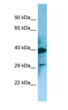 MCHR2 Antibody (C-Terminus)