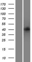 SOX5 Protein (Over-Expression Lysate Myc-DDK (Flag))