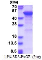 Human MGAT2 Protein (Recombinant His)
