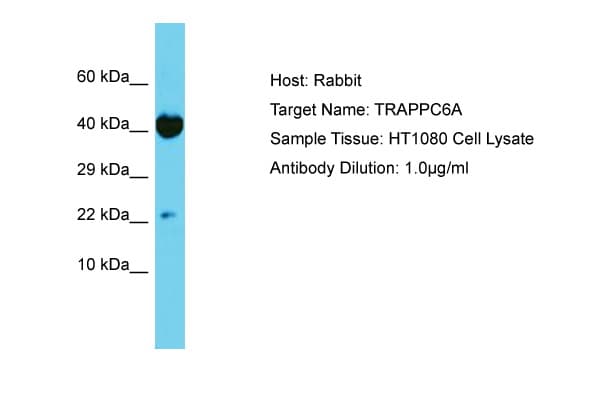 Polyclonal Rabbit anti-Human TRAPPC6A Antibody (aa21-70, WB)