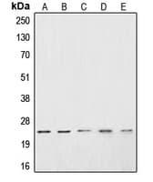CSRP1 Antibody (Internal)