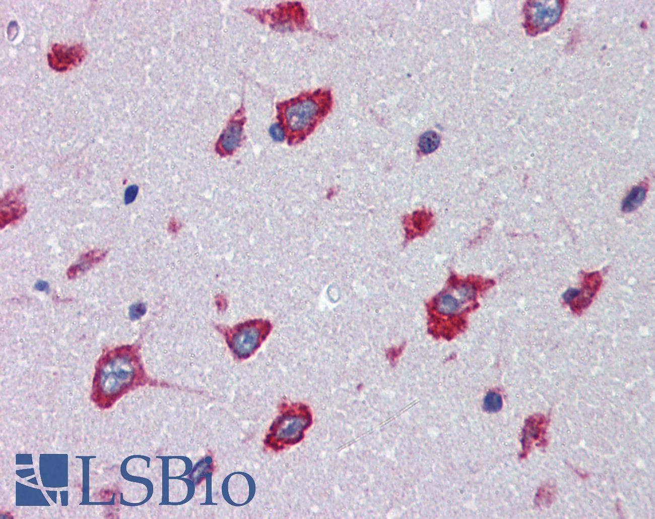 IHC-plus™ Polyclonal Rabbit anti-Human SRPX2 Antibody (C-Terminus, IHC)