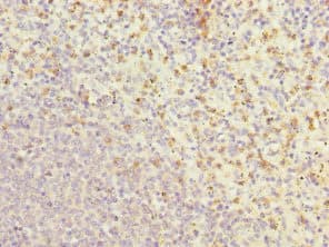 GCL / Grancalcin Antibody