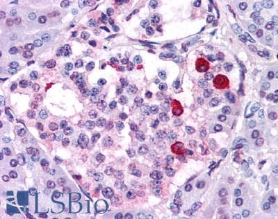 IHC-plus™ Polyclonal Rabbit anti-Human GIPR / GIP Receptor Antibody (N-Terminus, IHC)