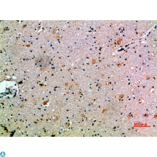 CCL14 Antibody