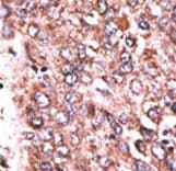 WISP3 Antibody (aa305-335)