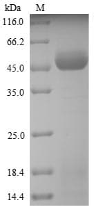 Ambrosia artemisiifolia PLY5 / Pectate Lyase 5 Protein (Recombinant 6His, N-terminus)
