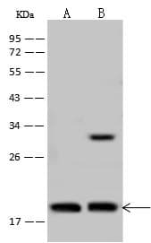 Polyclonal Rabbit anti-Human TCEAL3 Antibody (IHC, WB)