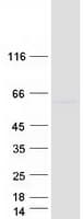 Human MEIS3 Protein (Recombinant Myc-DDK (Flag))