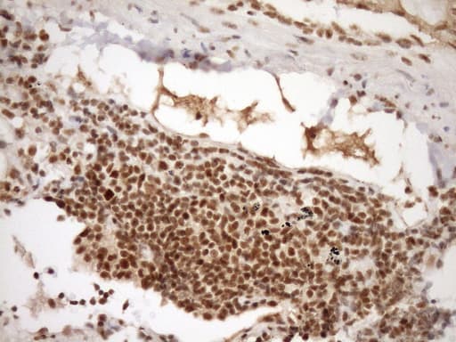 Monoclonal Mouse anti-Human SYF2 / p29 Antibody (clone OTI6A5, aa2-92, IHC, WB)
