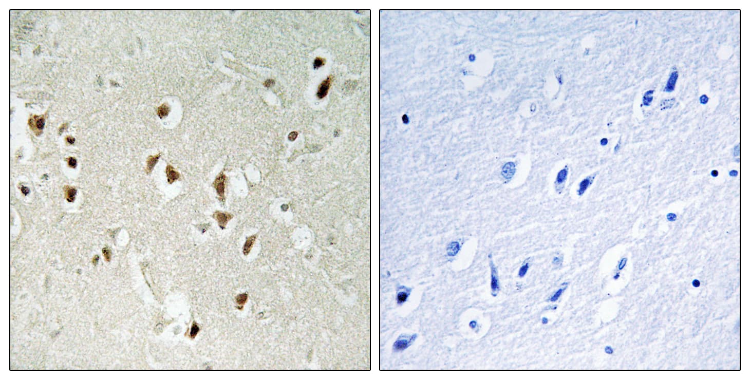 Polyclonal Rabbit anti-Human ARHGAP35 / GRLF1 Antibody (aa1071-1120, IHC)