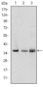 LIMS1 / PINCH Antibody (clone 5G7)