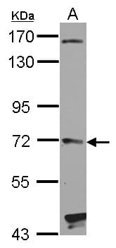 Polyclonal Rabbit anti-Human HHIP / HIP Antibody (WB)