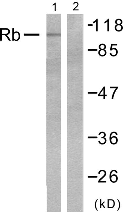 RB1 / Retinoblastoma / RB Antibody (p795)