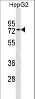 ZNF614 Antibody (aa174-200)