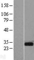 SPSB2 Protein (Over-Expression Lysate Myc-DDK (Flag))