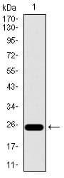 IHC-plus™ ITGB4 / Integrin Beta 4 Antibody (aa1619-1822, clone 10B10D5)