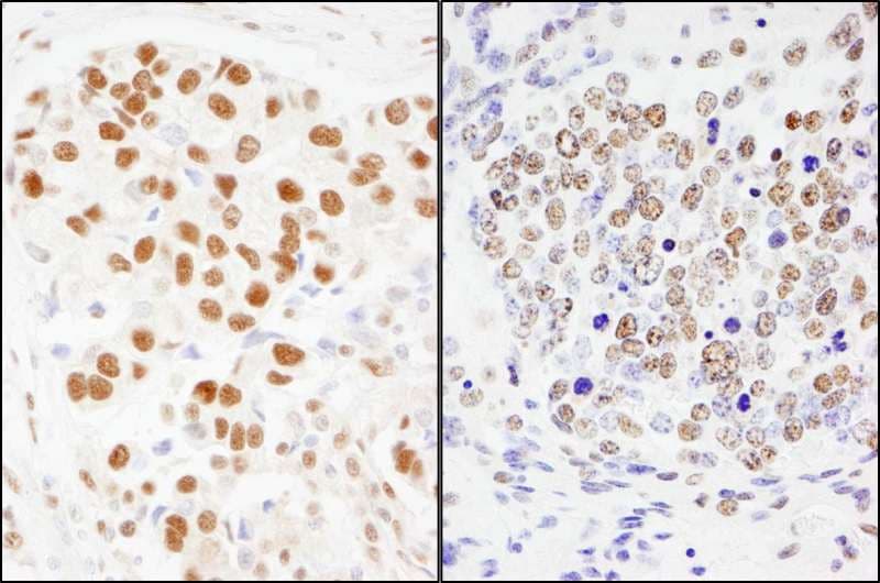 SF3A1 / SF3A120 Antibody (aa350-400)