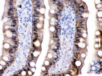 I-FABP / FABP2 Antibody