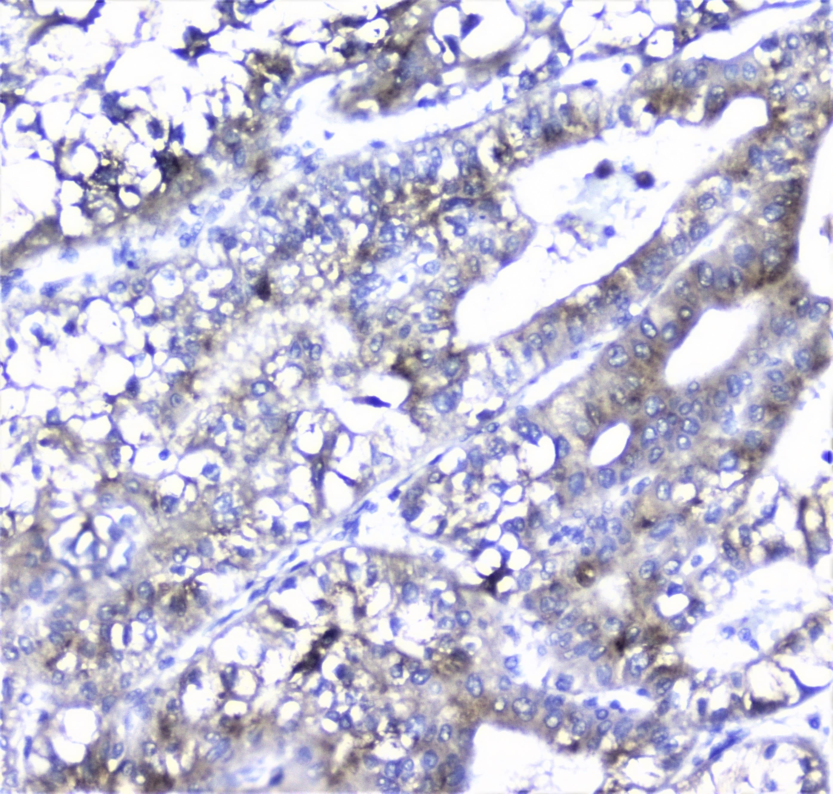 AMBP Antibody