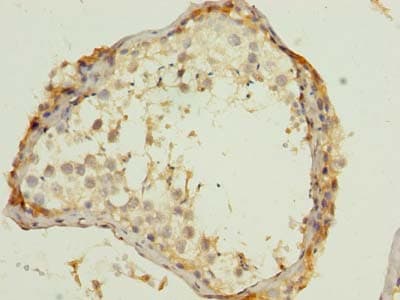 Polyclonal Rabbit anti-Human WNT4 Antibody (IHC, WB)