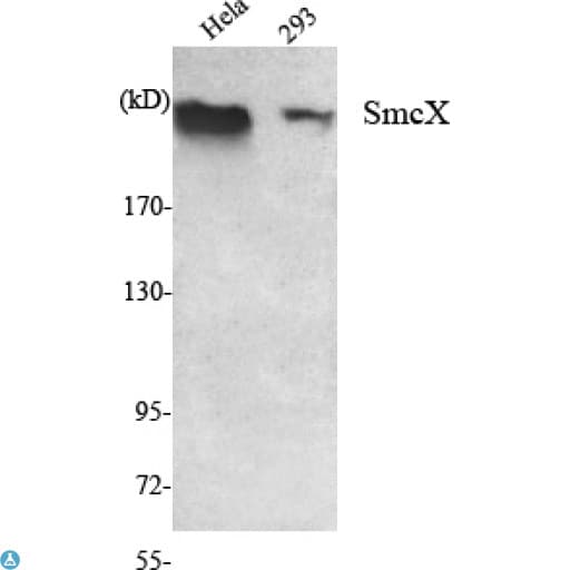 KDM5C / Jarid1C / SMCX Antibody