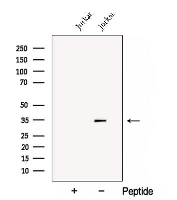 CNOT8 Antibody