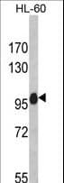 NLRP12 Antibody (aa800-1061)