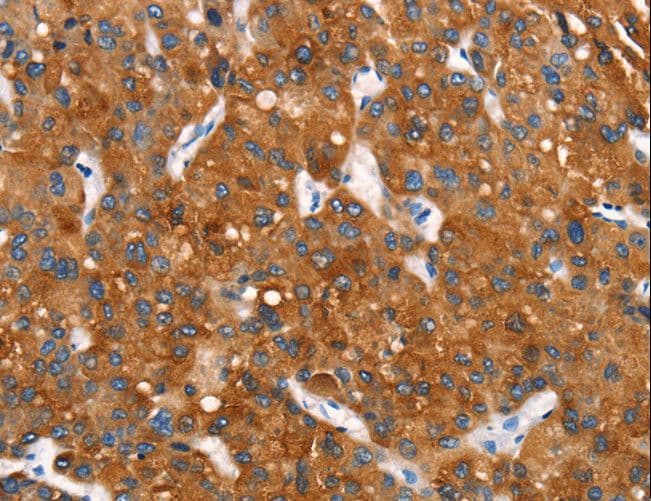 Cytochrome b Antibody