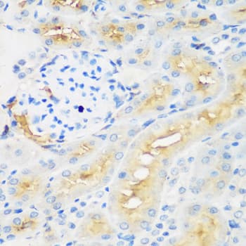 PROCR / EPCR Antibody